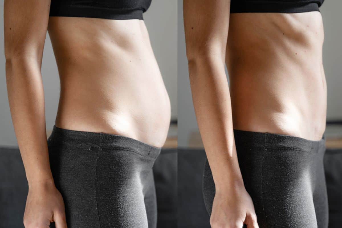 Post-Pregnancy: What Happens to Your Abdominal Muscles After Birth Upton