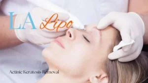 Woman receiving Actinic Keratosis Removal Treatment Upton
