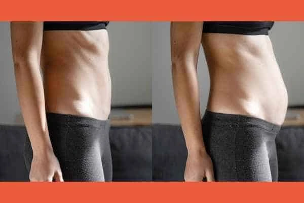 LA-EMS Body Sculpting results Upton