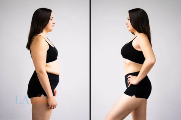 link between body image and mental health Upton