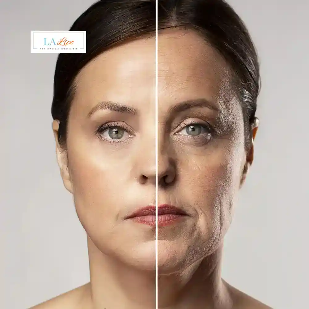 How Can You Tell If Non-Surgical Skin Tightening Is Right for You Upton?