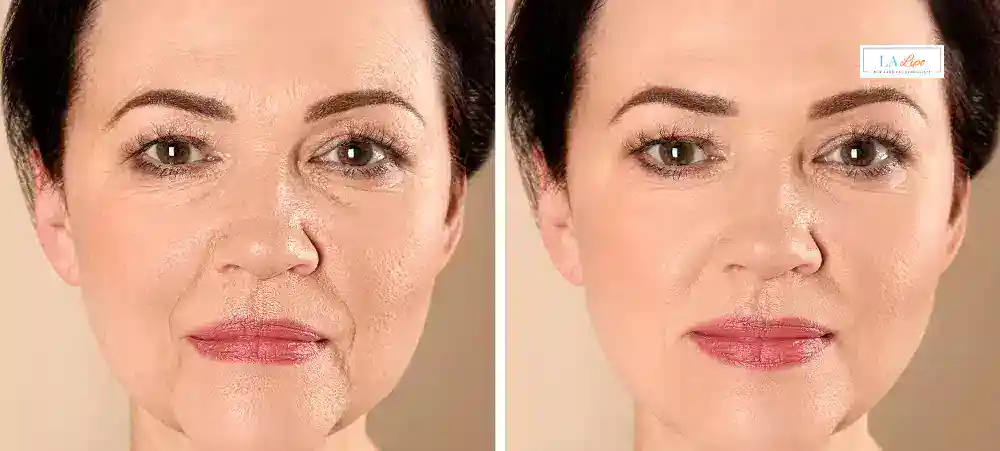 Why Aren’t My Skincare Products Making My Sagging Skin Look Firmer Upton?