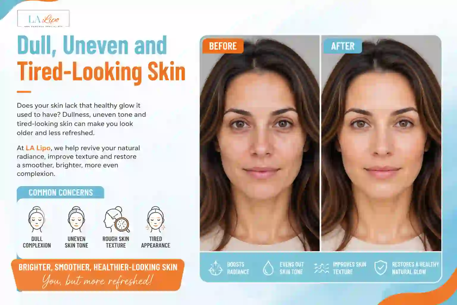 Sign #5: Dull, Uneven and Tired-Looking Skin Upton