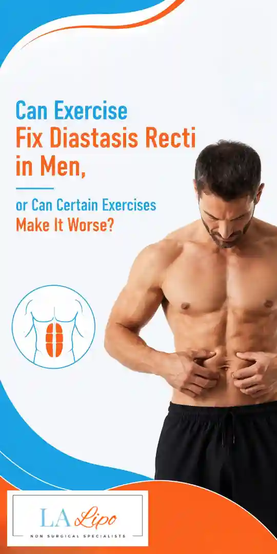 Can Exercise Fix Diastasis Recti in Men, or Can Certain Exercises Make It Worse Upton?